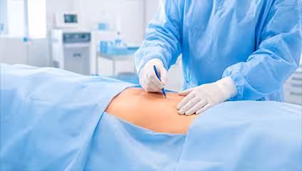 liposucción montevideo liposucción montevideo