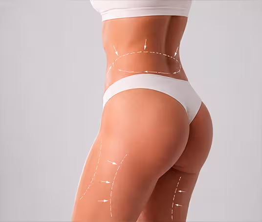 lipotransferencia en uruguay