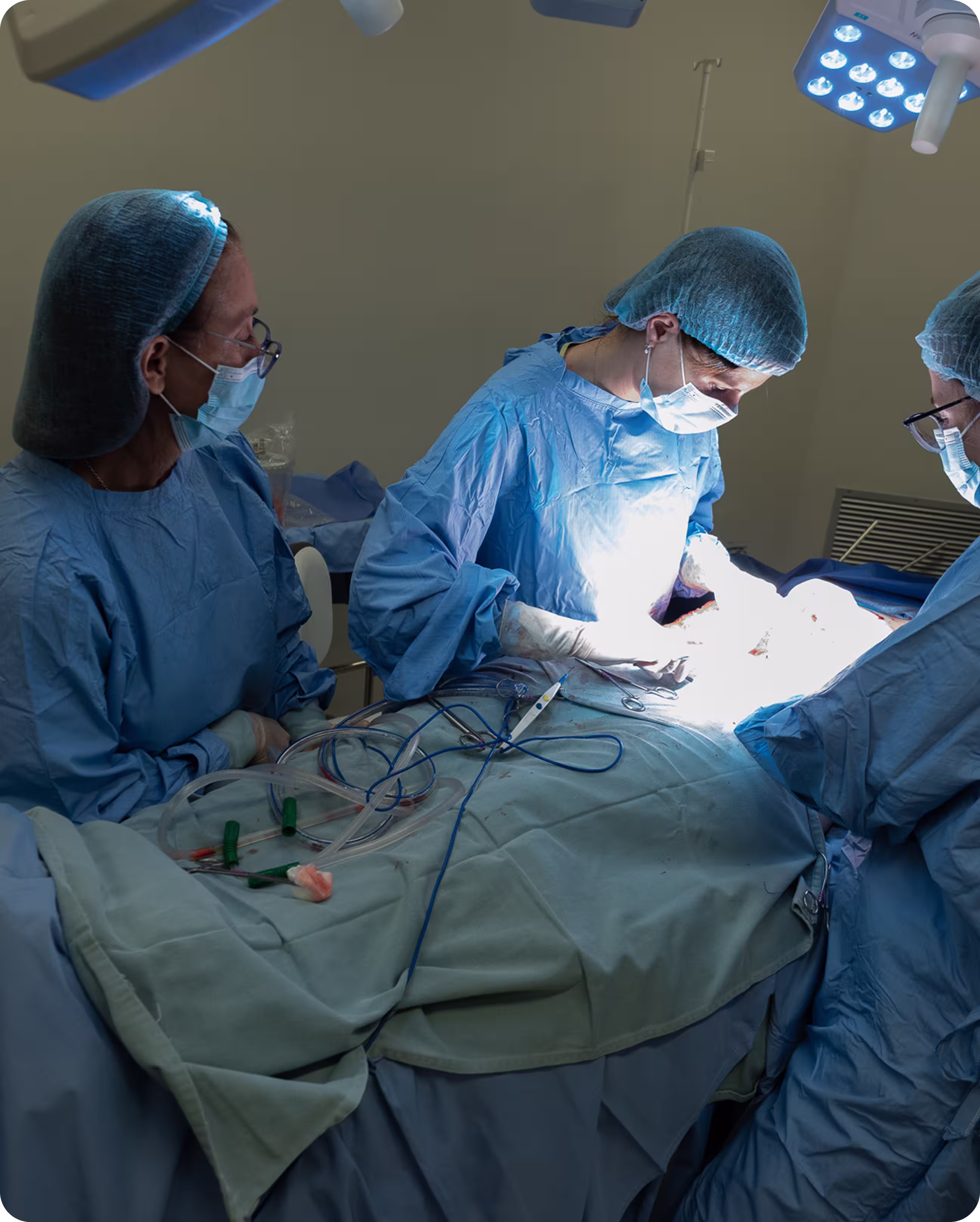 abdominoplastia