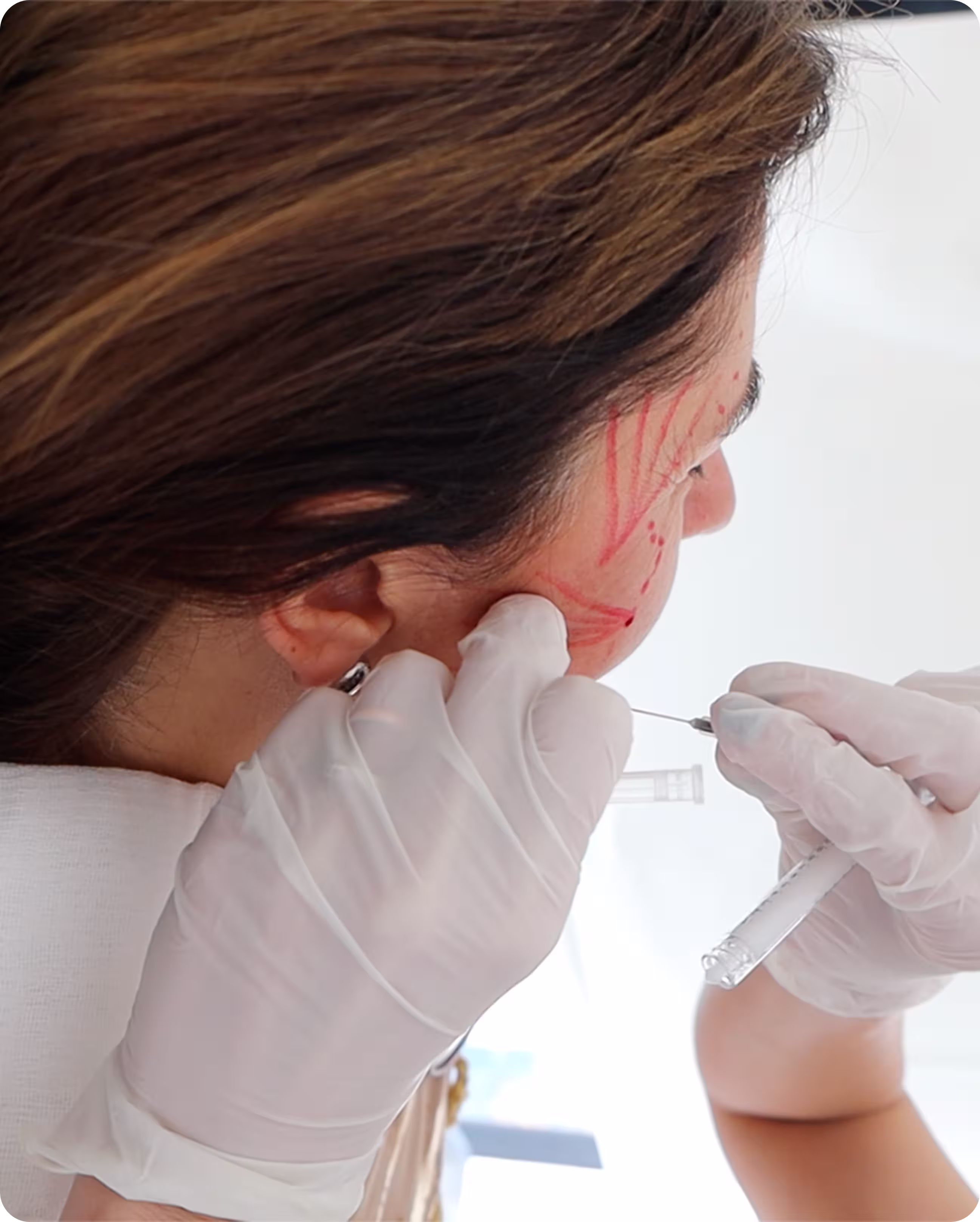 perfilado de labios